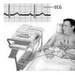 ประวัติการตรวจคลื่นไฟฟ้าหัวใจ